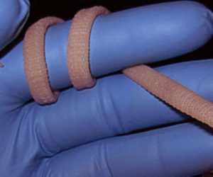 Des vaisseaux sanguins artificiels ? C’est possible grâce à l’ingénierie tissulaire